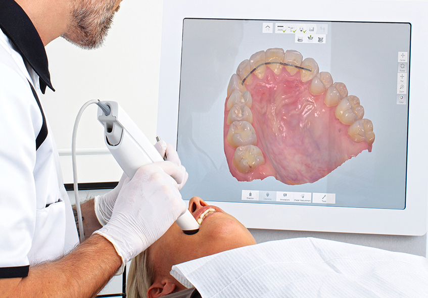 Cerec chair side system