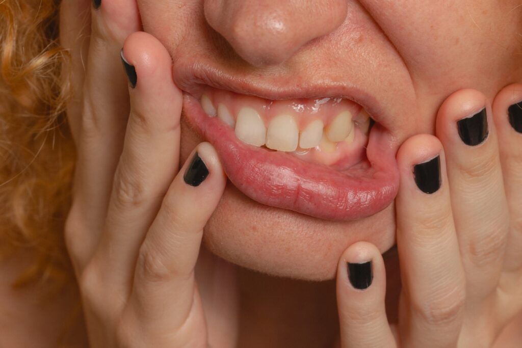 teeth grinding and TMD treatment