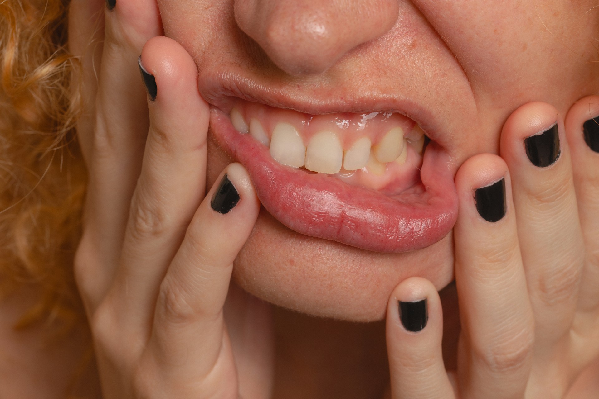 Stop Teeth Grinding and Ease Jaw Pain and Sleep