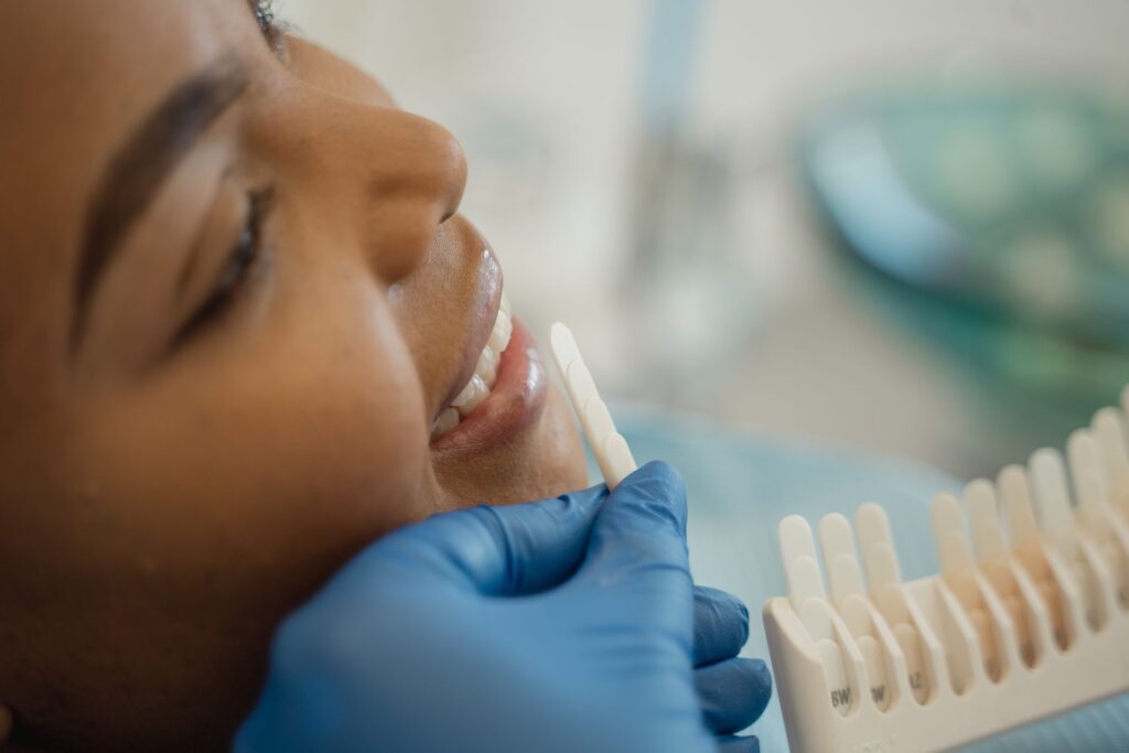 Summer Teeth Whitening