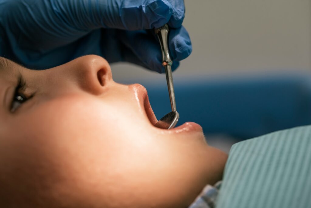 Kids’ Dental Crowns